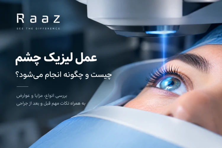 عمل لیزیک چشم چیست و چگونه انجام می‌شود؟ بررسی انواع، مزایا و عوارض